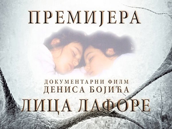 лица-лафоре-